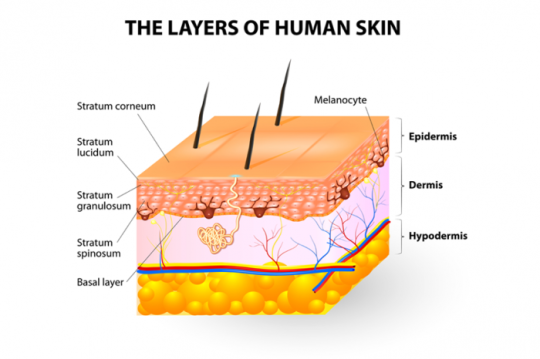 Stretch Marks in Pregnancy